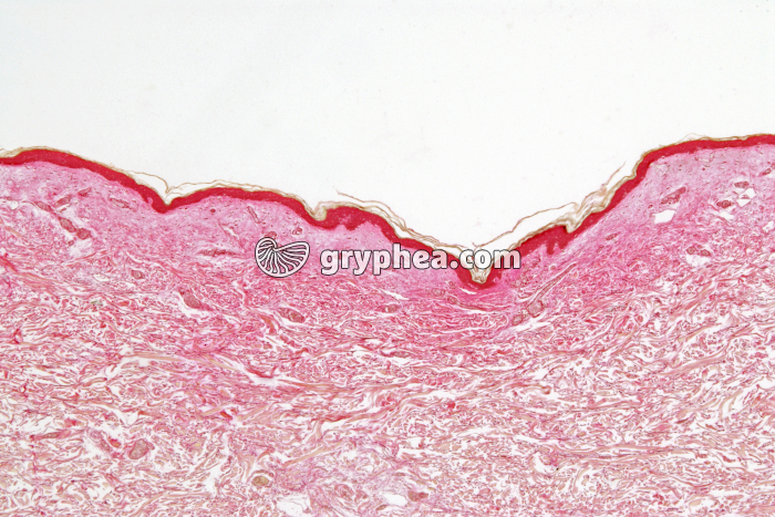 Peau non pigmentée (race blanche) CT x10 - gryphea.org